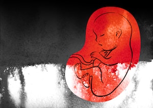 300x212 Pregnancy Loss Counseling Focal Point Art Therapy - Fetus Painting