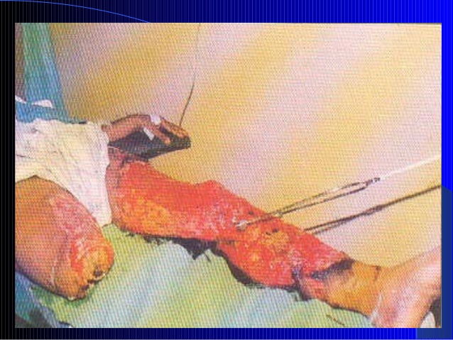 638x479 First Aid Slide - First Aid Painting