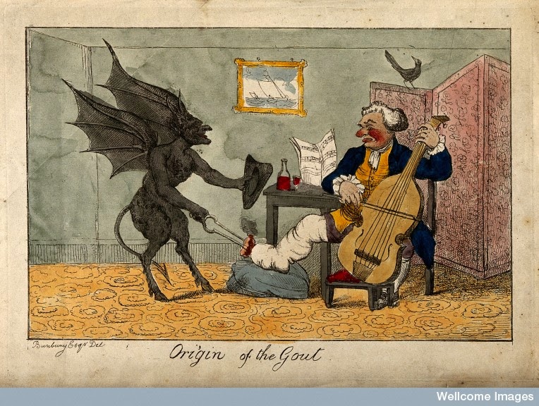 764x576 Hx Medical Historia G - Gout Painting