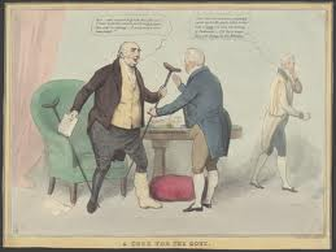 336x252 Samui Health Article - Gout Painting