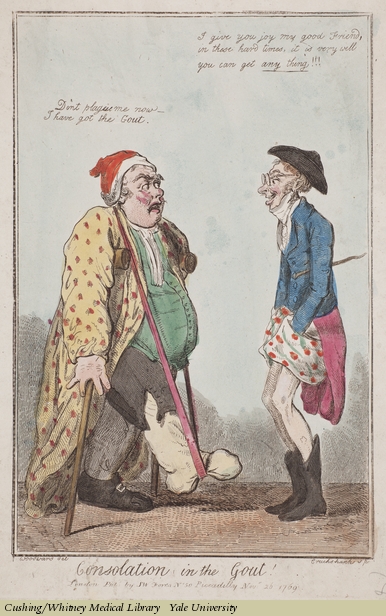 386x616 Consolation In The Gout! - Gout Painting
