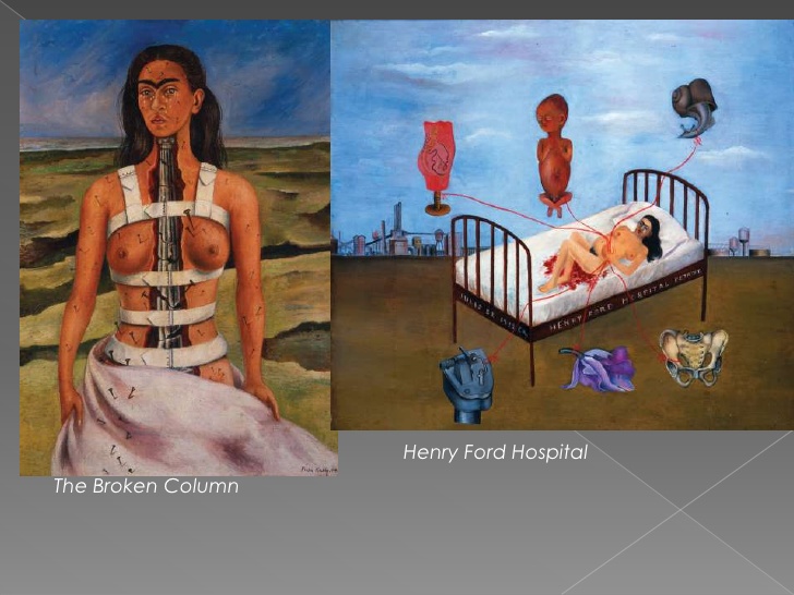 728x546 Frida Kahlo Project - Henry Ford Hospital Painting
