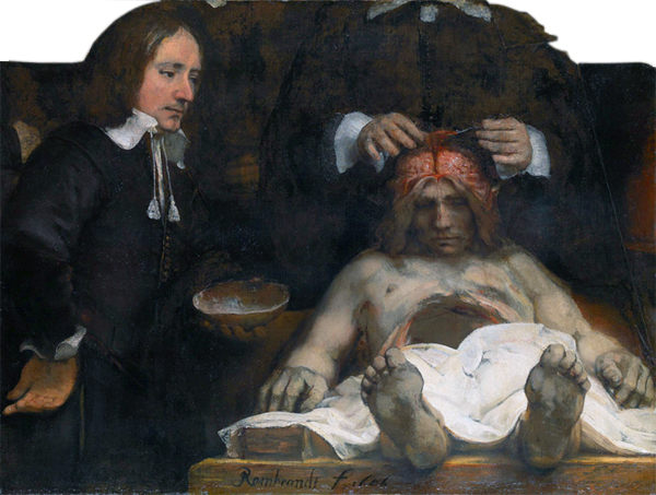 600x453 The Anatomy Lesson Of Dr. Deijman - Jesus Surgery Painting