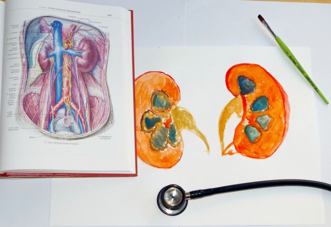 663x454 Do You Play - Kidney Painting