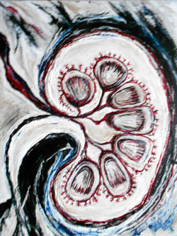 250x333 Gallery 1 - Kidney Painting