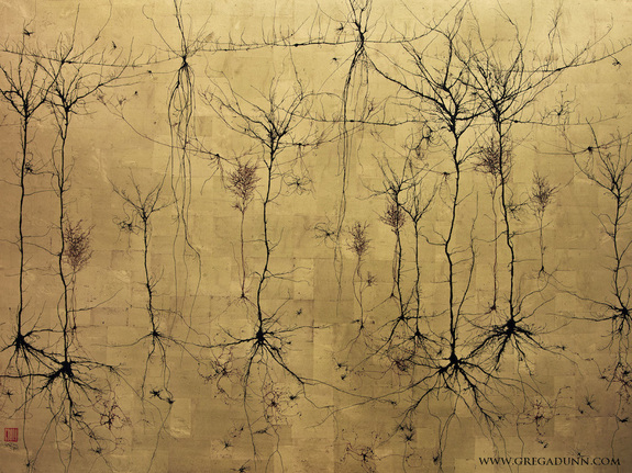 575x431 Stunning Neurons On Canvas Painted By A Neuroscientist - Neuron Painting