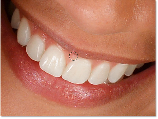 640x484 How To Whiten Teeth In Photoshop - Painting Of Teeth