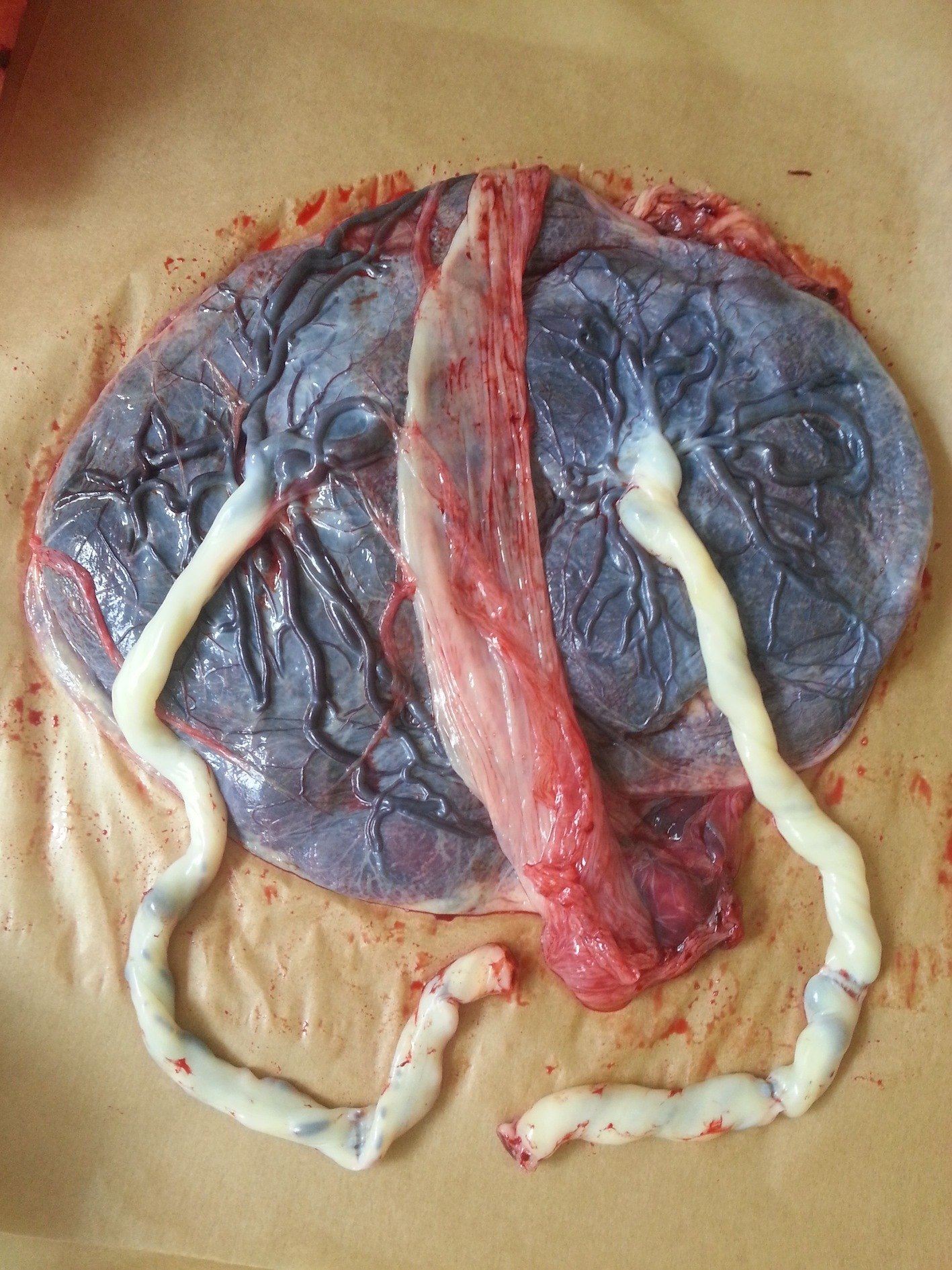 1417x1890 Placenta Printing - Placenta Painting