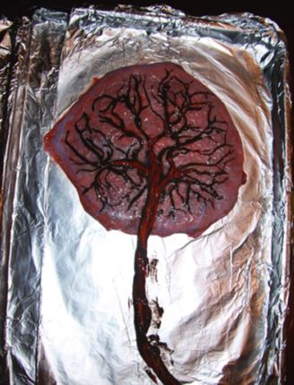 328x430 Placenta Art Parent24 - Placenta Painting