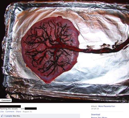 500x459 Stfu, Parents - Placenta Painting