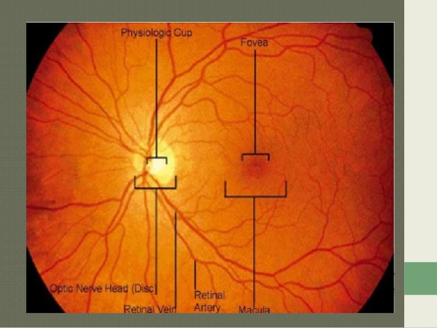 638x479 Anatomy Of Macula - Retinal Painting