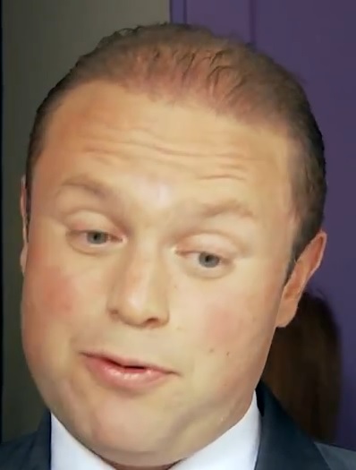 398x525 Michelle Used To Have This Look, But She Doesn'T Anymore. It'S - Scalp Painting