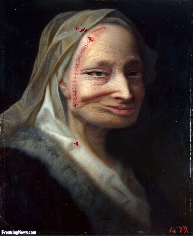 800x976 Woman With Botched Plastic Surgery Painting Pictures - Surgery Painting