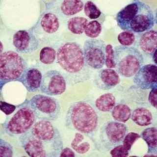 320x320 A Classic Image Of Uroscopy - The Physician Painting 1653