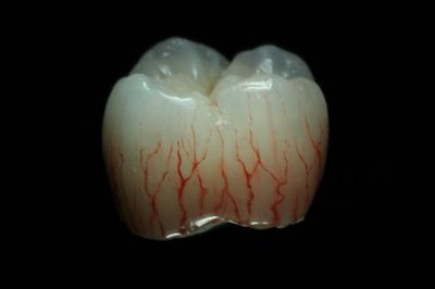 400x266 Tooth Painting - Tooth Painting