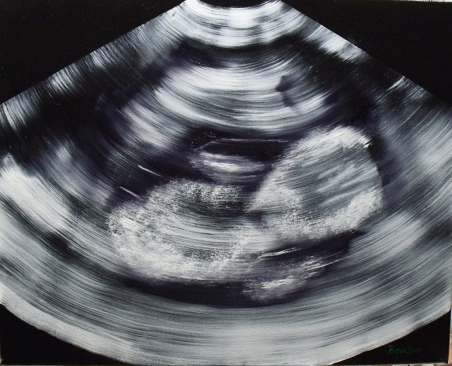 900x728 Ultrasound' Painting By Donbowling - Ultrasound Painting