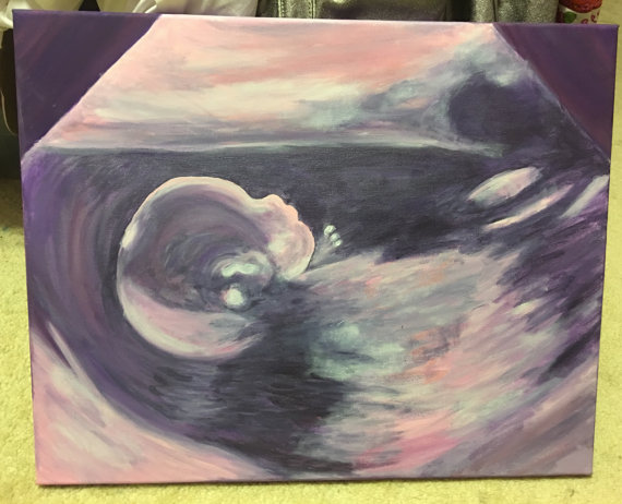 570x462 Ultrasound Paintings - Ultrasound Painting
