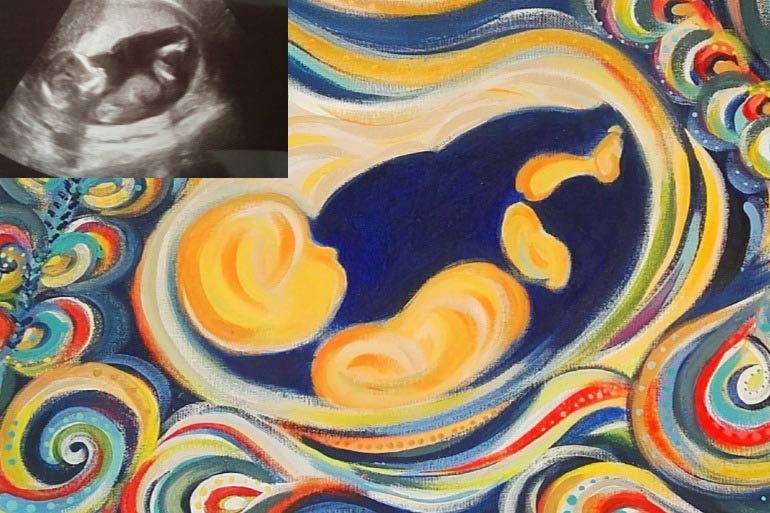 770x513 Yes, It's True. You Can Turn Your Ultrasound Into A Work Of Art - Ultrasound Painting