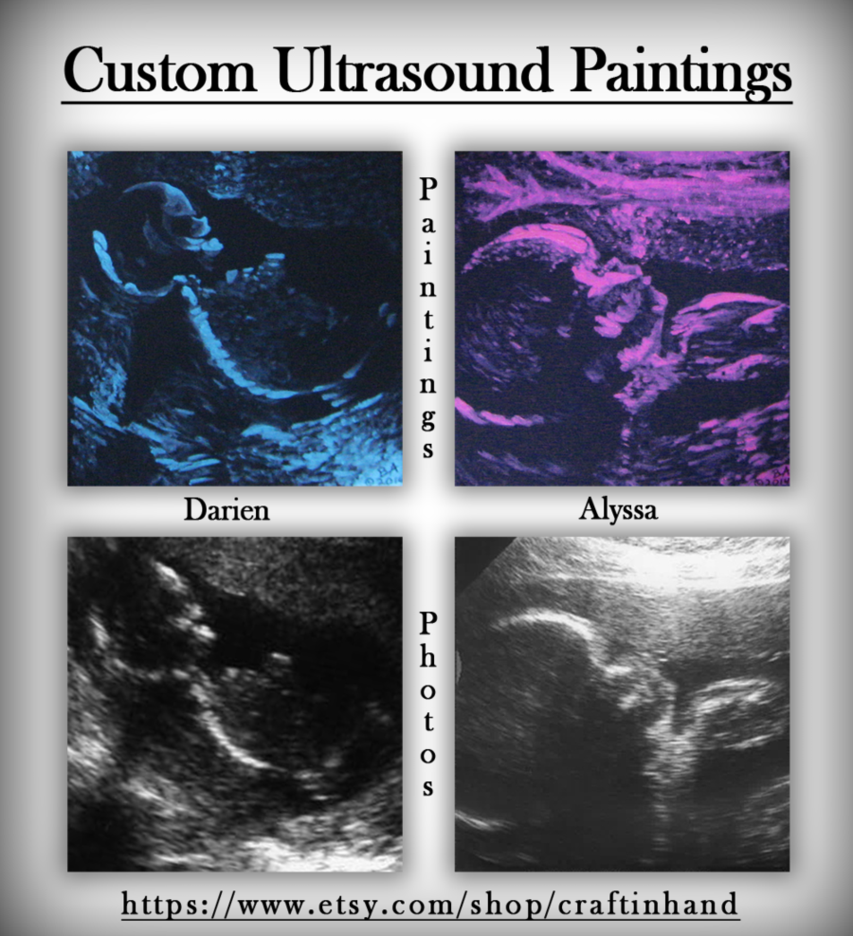 853x936 Custom Ultrasound Paintings By Grammabeth - Ultrasound Painting