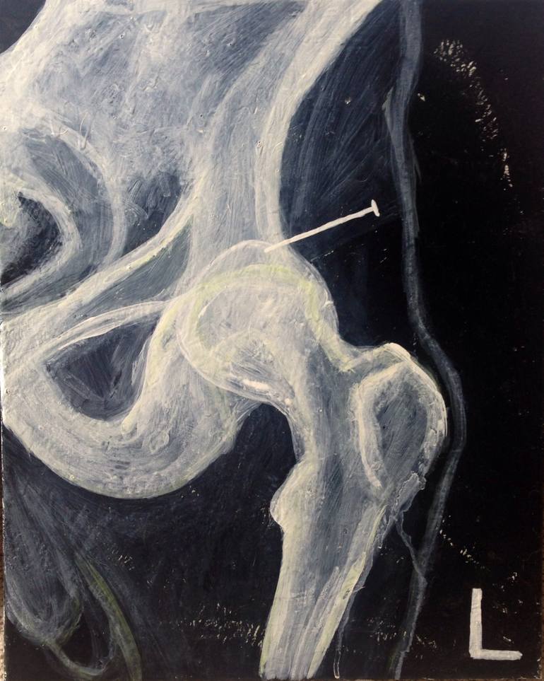 770x963 Saatchi Art Hip Impalement X Ray Painting By Drew Bowyer - X Ray Painting