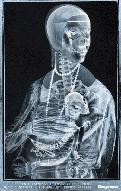 401x630 Painting Xray Dejoule169 - X Ray Painting