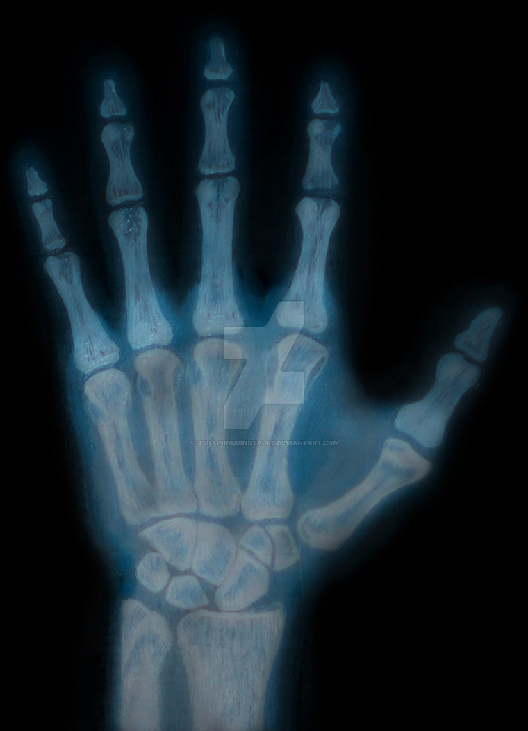 760x1052 Hand X Ray Painting By Itsrainingdinosaurs - X Ray Painting