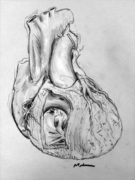 450x600 Anatomical Sketches Spilt Martini - Anatomical Sketches