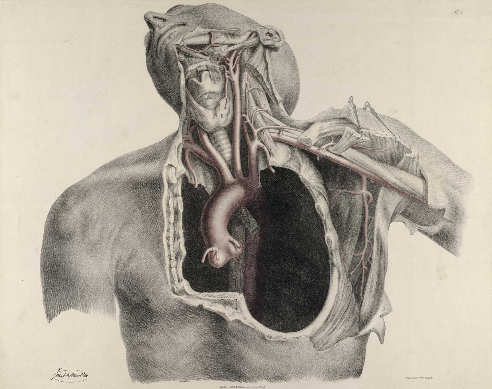 1600x1263 Historical Anatomies On The Web Browse Titles - Anatomical Sketches
