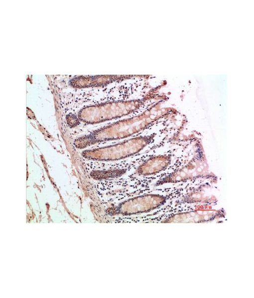 510x600 Validated Anti Atm Rabbit Antibody Antibodyplus Antibody Trial - Atm Sketch
