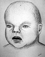150x188 List Of Unidentified Murder Victims In Florida - Baby Doe Sketch