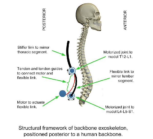 627x572 Concept Sketch Of Proposed Backbone Exoskeleton. Download - Backbone Sketch