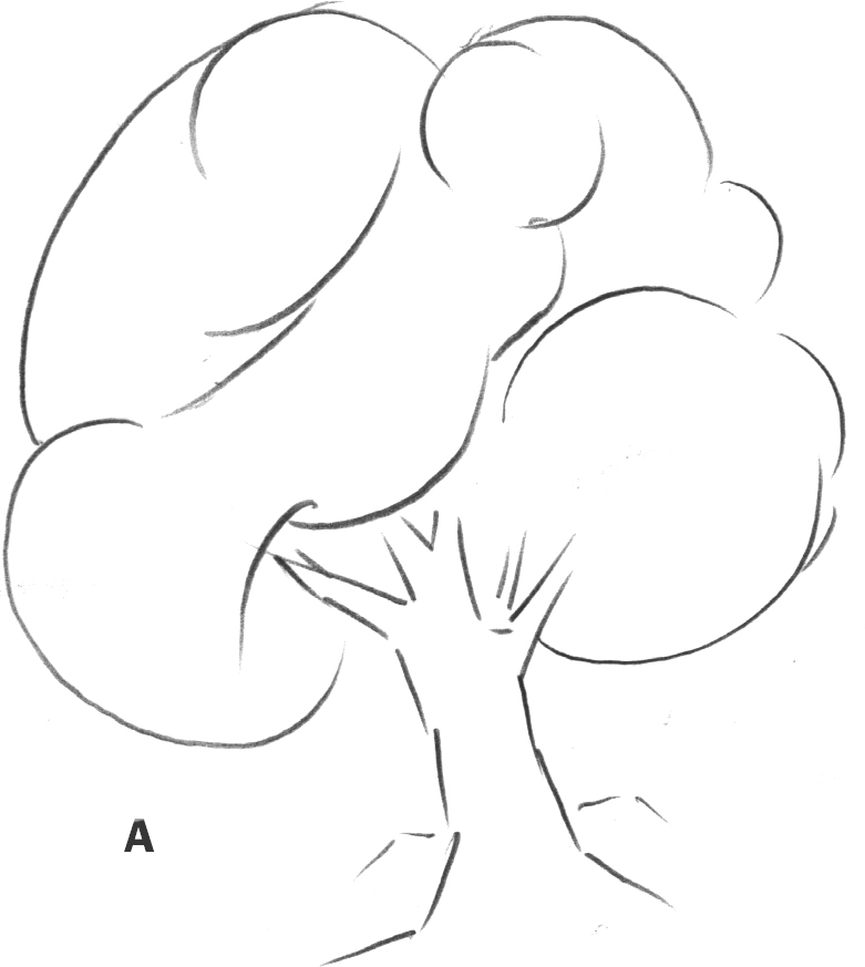 781x873 Begin With Simple Shapes - Basic Tree Sketch