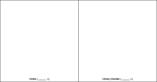 505x265 Solved Sketch A Cross Section Of A Ureter And Label The Three - Bladder Sketch
