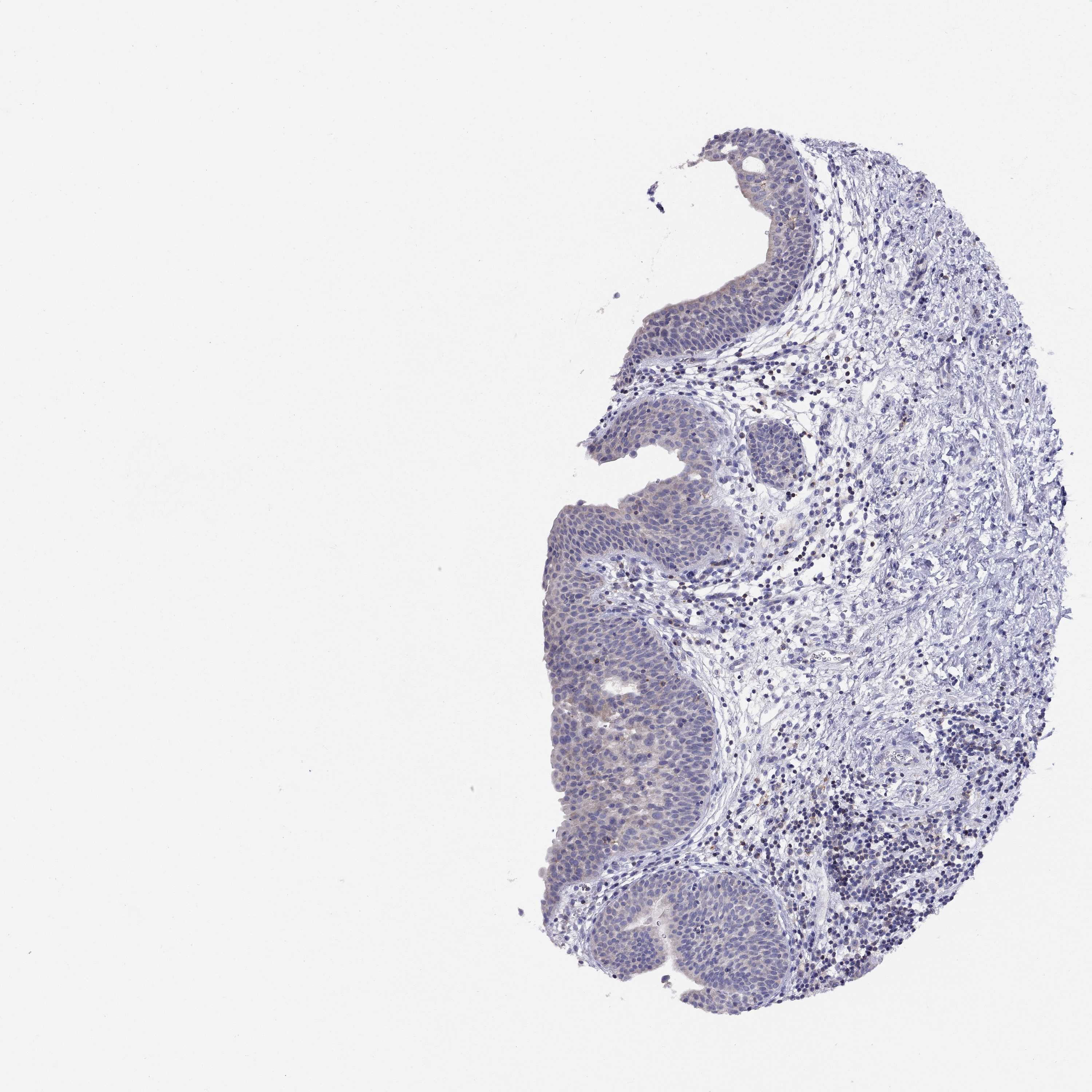3000x3000 Tissue Expression Of Cited1 - Bladder Sketch