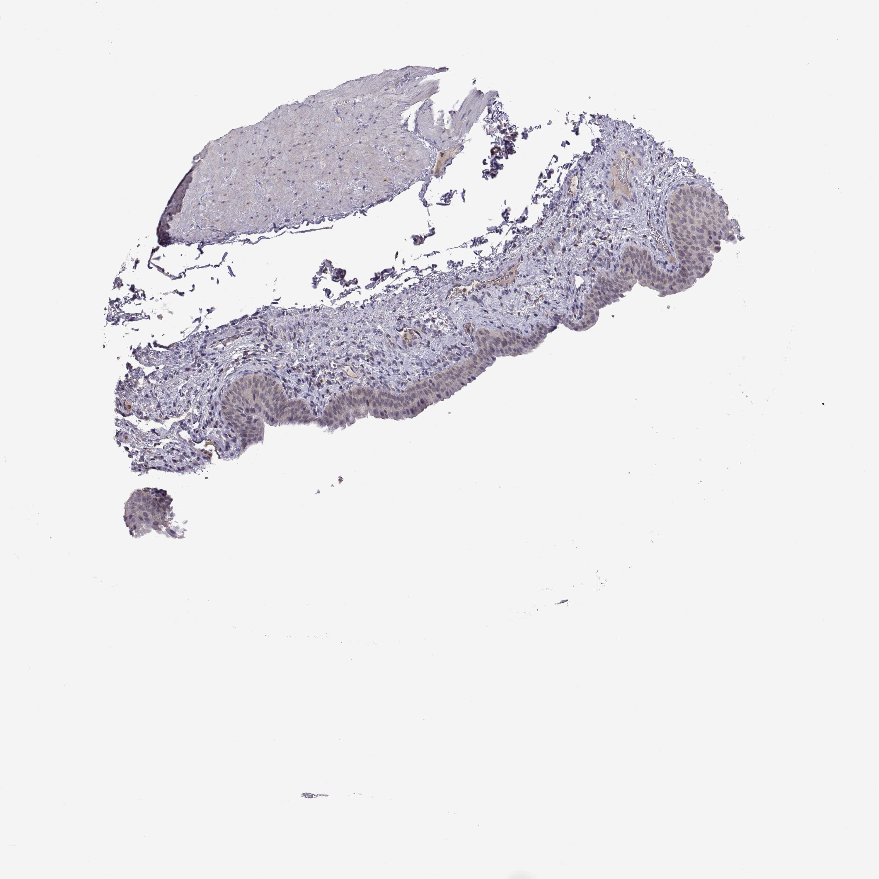 3000x3000 Tissue Expression Of Fgf9 - Bladder Sketch