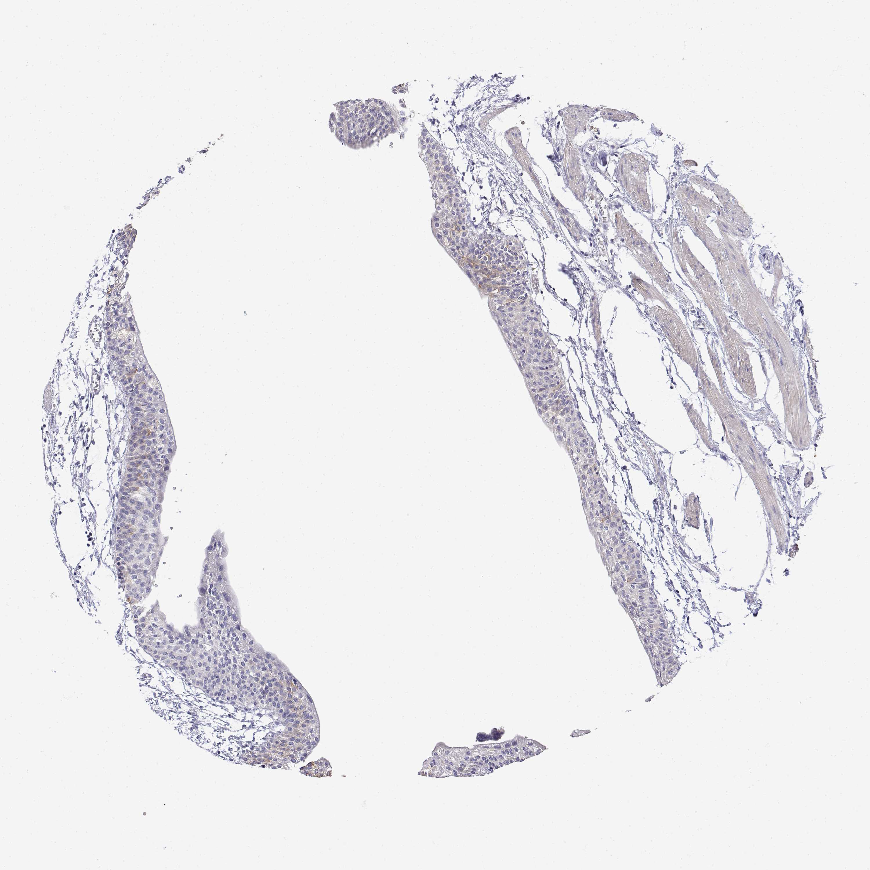 3000x3000 Tissue Expression Of Ly6d - Bladder Sketch