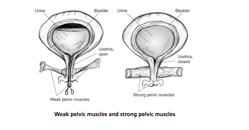 501x262 Urinary Incontinence Treatment Amp Diagnosis Clinical Research Omaha - Bladder Sketch