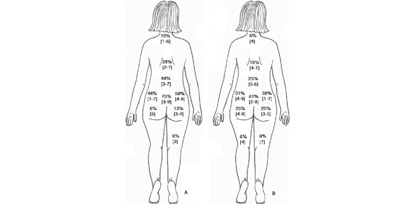 850x438 Pain Drawings Results - Blank Body Sketch