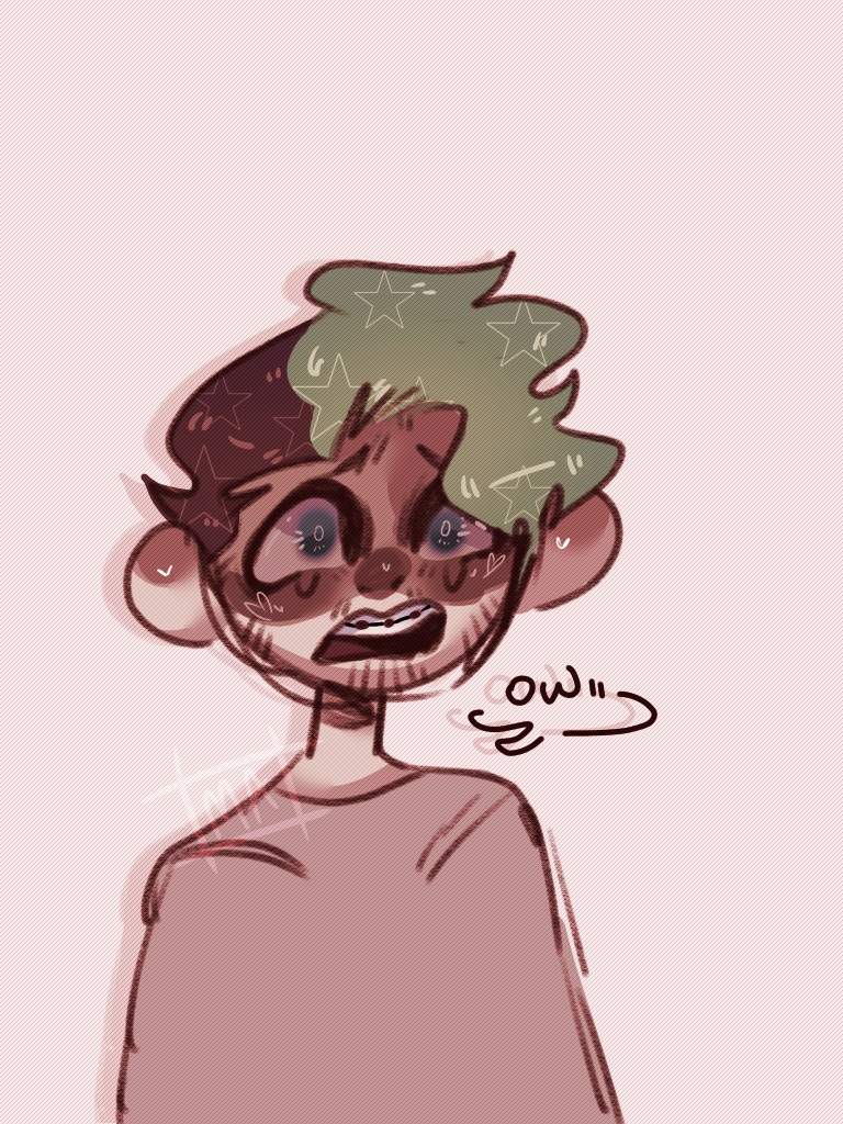 768x1024 Braces - Braces Sketch