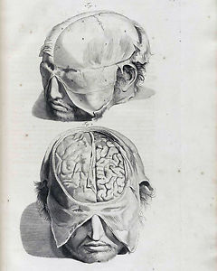 240x300 Vintage Medical Illustration Surgery Brain Anatomy Real Canvas Art - Brain Anatomy Sketch