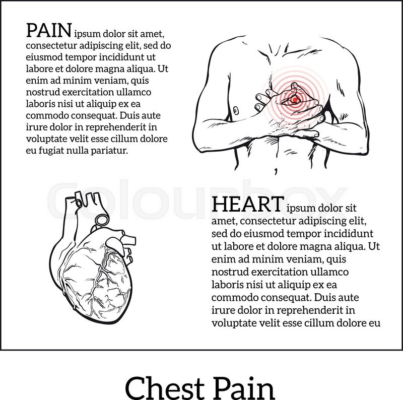 800x794 Information About Heart Pain, Chest Pain In Men, Anatomical Image - Chest Sketch
