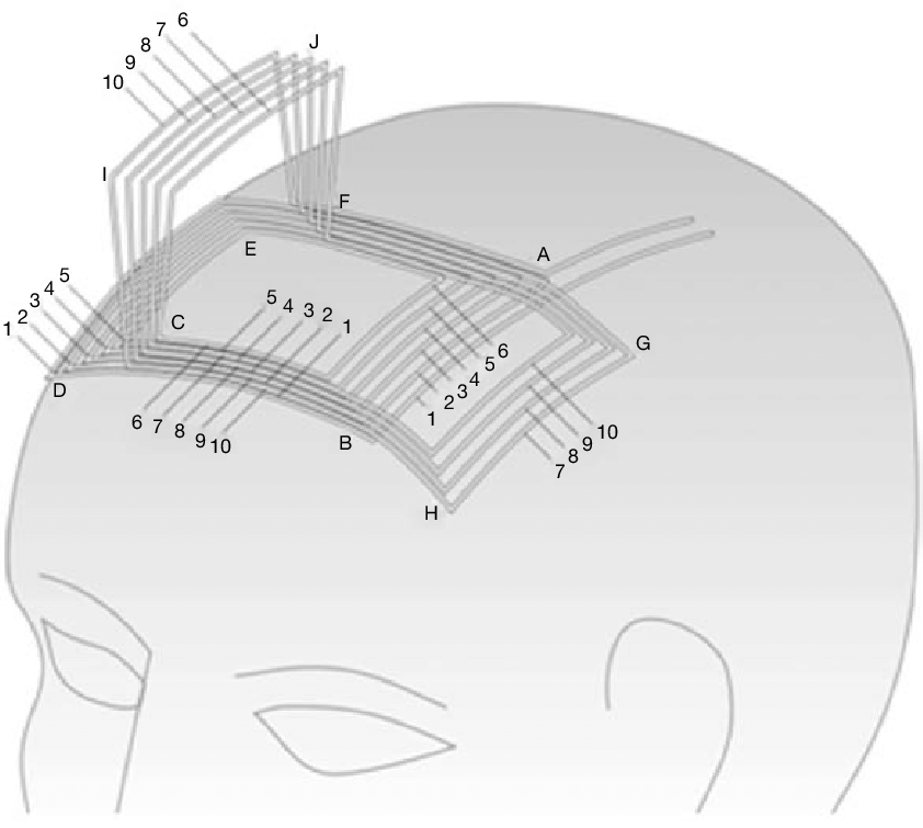 Coil Sketch at Explore collection of Coil Sketch