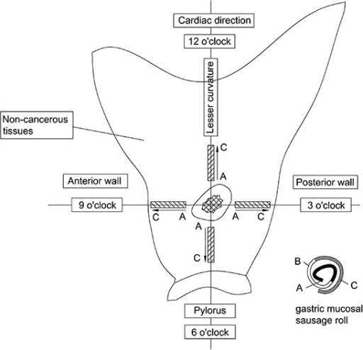 512x494 Diagrammatic Sketch For Mucosal Sausage Roll Open I - Diagrammatic Sketch