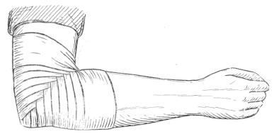 394x189 Bandaging Arms - Elbow Sketch