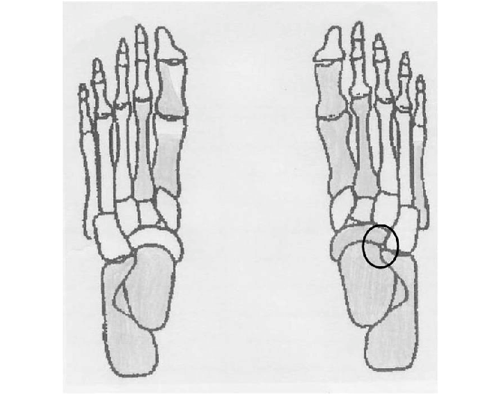 720x567 Preserved Foot Bones (In Gray) Of The Female Skeleton Labeled 29 - Female Skeleton Sketch