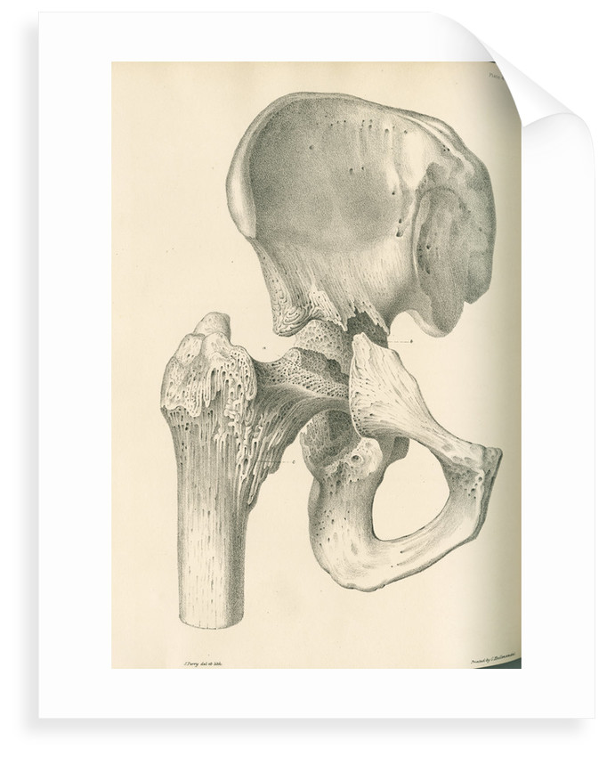 682x850 Front View Of The Right Hip And Femur Posters Amp Prints By J Perry - Femur Sketch
