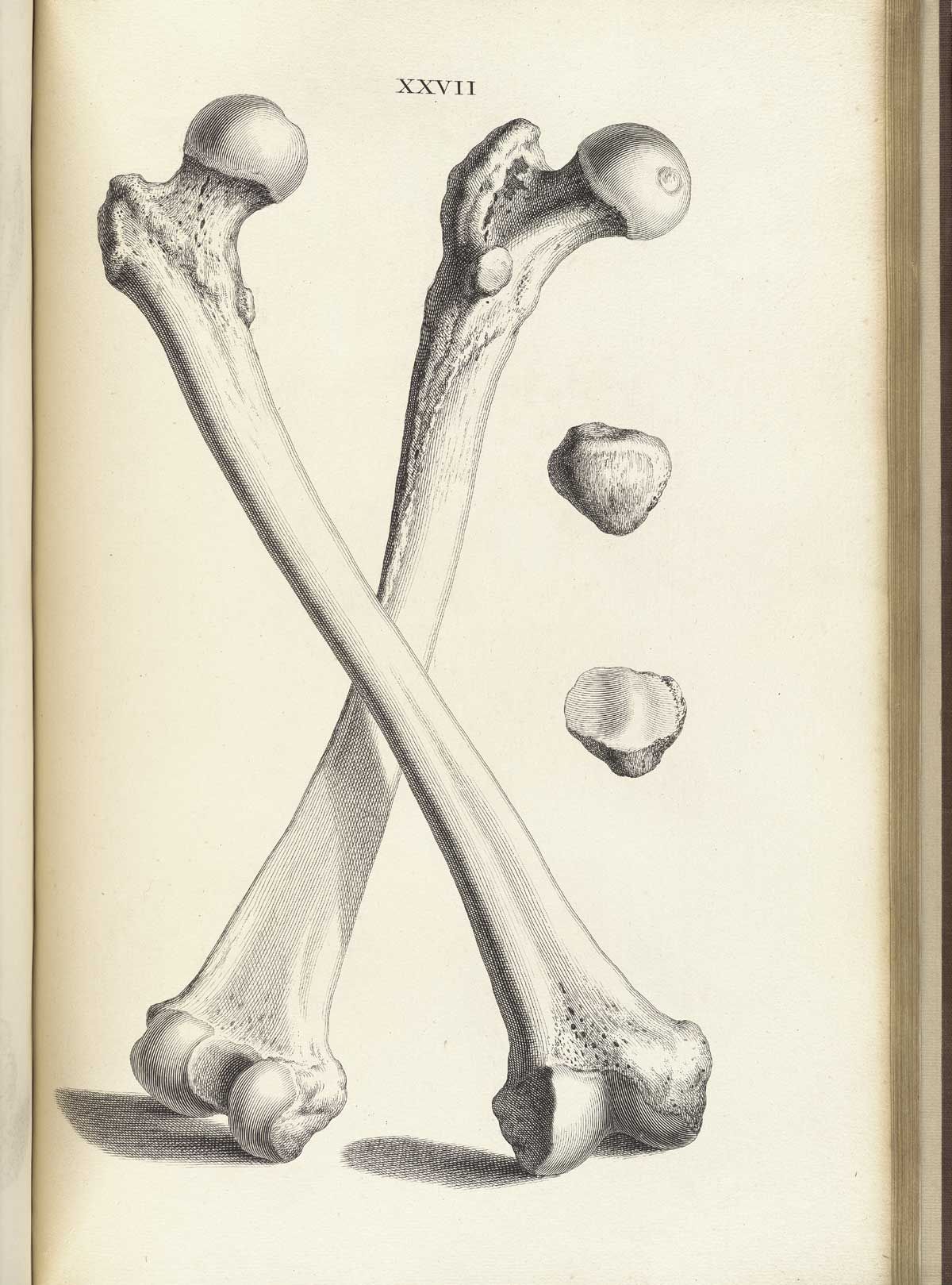 1200x1619 William Cheseldon - Femur Sketch