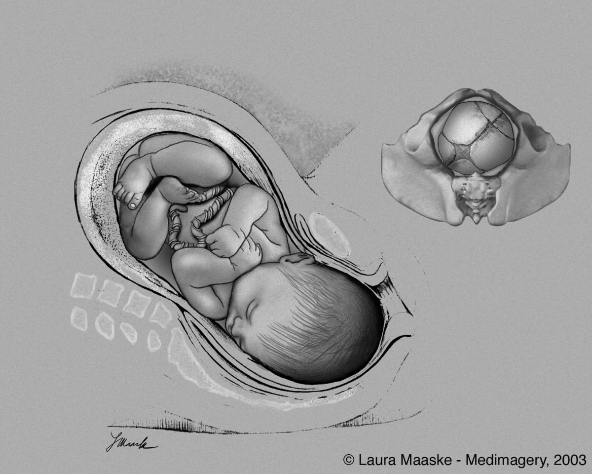 Fetal Position Sketch At Explore Collection Of Fetal Position Sketch 8164