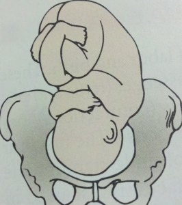 266x300 What Is The Name Of The Fetal Position Shown In The Image Below - Fetal Position Sketch