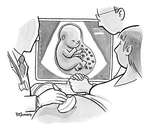 300x259 Fetus Drawings Fine Art America - Fetus Sketch